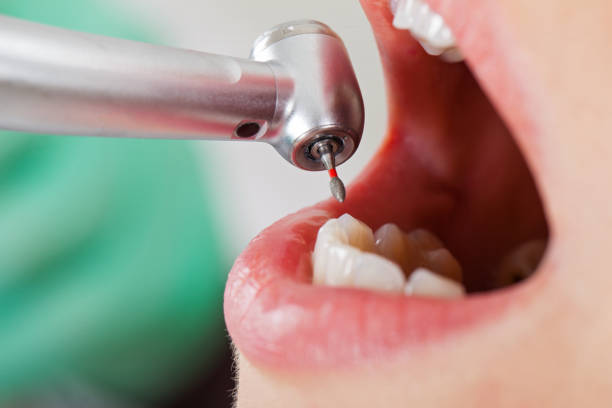 Best Walk-In Emergency Dental Services in Belington, WV